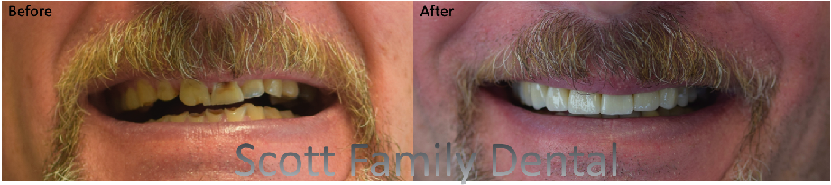 Scott Family Dental