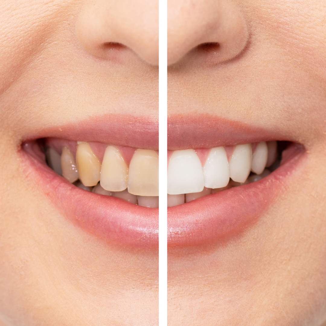 Image of M City Dental – Dr. Mahmoud Manzoor & Associates clinic - Dental Clinic Directory