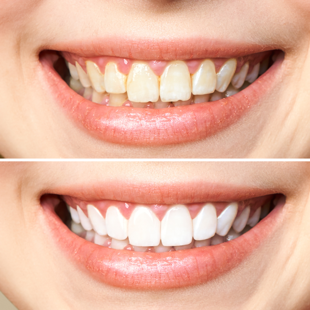 M City Dental – Dr. Mahmoud Manzoor & Associates