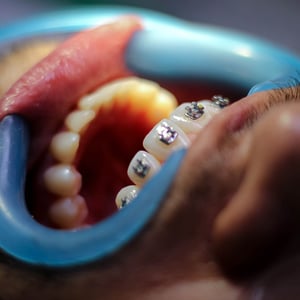 Image of Smileworks Orthodontics clinic - Dental Clinic Directory