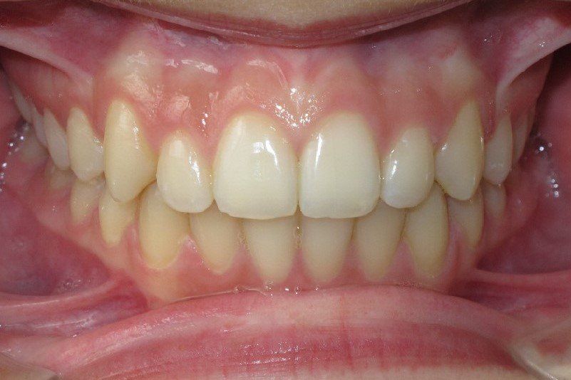 City Centre Orthodontics - Dr. Ziad Omar