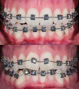 Image of BHG Orthodontics clinic - Dental Clinic Directory