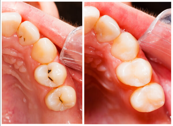 Image of Malvern Town Centre Dental - Family, Cosmetic, Orthodontic and Implant Dentistry clinic - Dental Clinic Directory