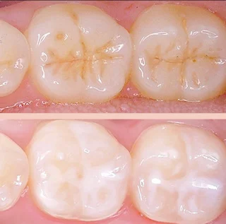Maple Dental Centre Dr.Sophie