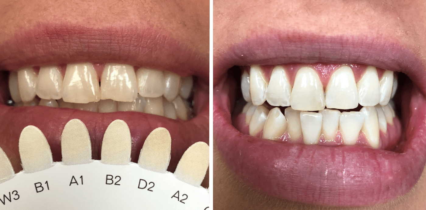 Maplewood Dental