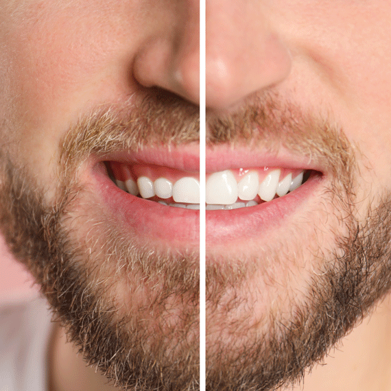 Markdale Family Dental