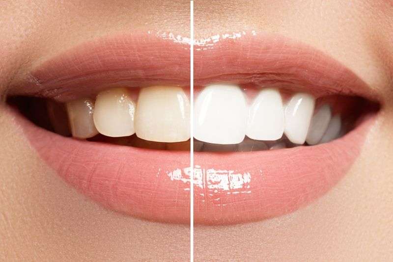 Markham Gateway Dentistry