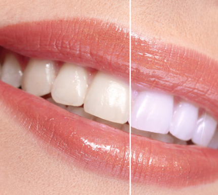 Image of Maxwell Heights Dental clinic - Dental Clinic Directory