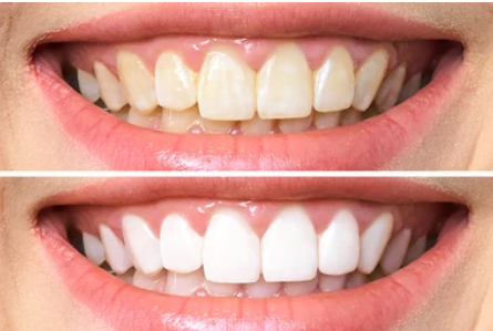 Image of Maxwell Heights Dental clinic - Dental Clinic Directory