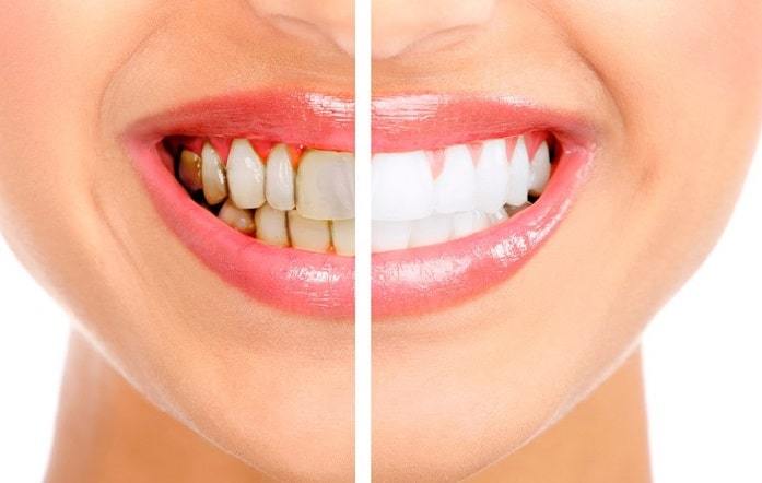 Mehan Dental