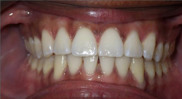 Image of Orthodontic Studio @Royal York clinic - Dental Clinic Directory