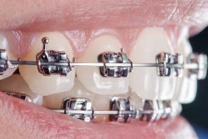Image of Orthodontic Studio @Royal York clinic - Dental Clinic Directory