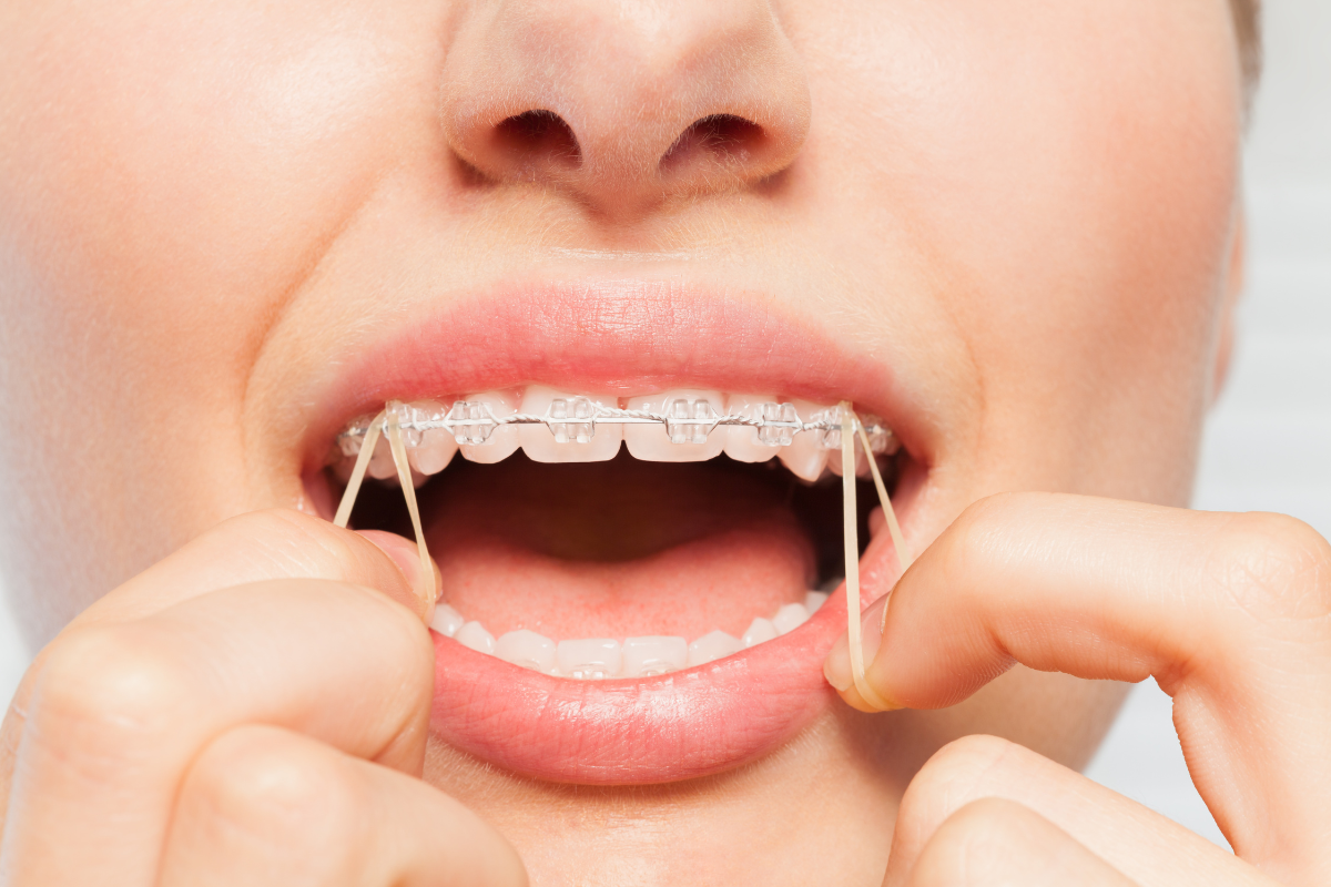 Image of Orthodontic Studio @Royal York clinic - Dental Clinic Directory
