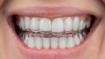 Image of Ottawa Smiles Family Dental clinic - Dental Clinic Directory
