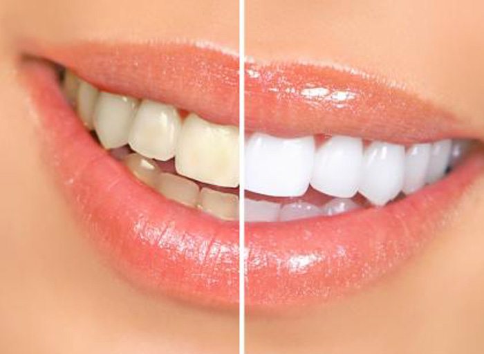 Image of Pineview Dental clinic - Dental Clinic Directory