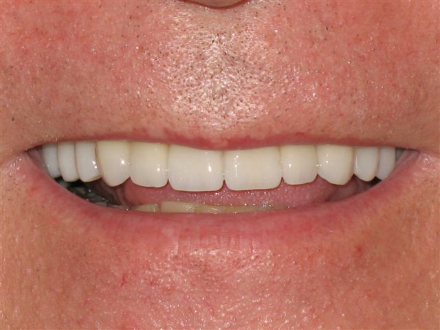 Port Carling Dental