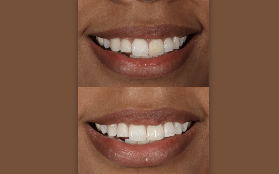 Richmond West Dental