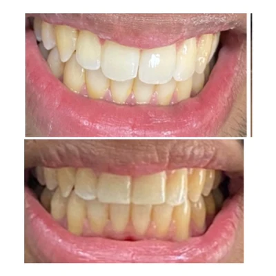 Image of Revita Dentist clinic - Dental Clinic Directory