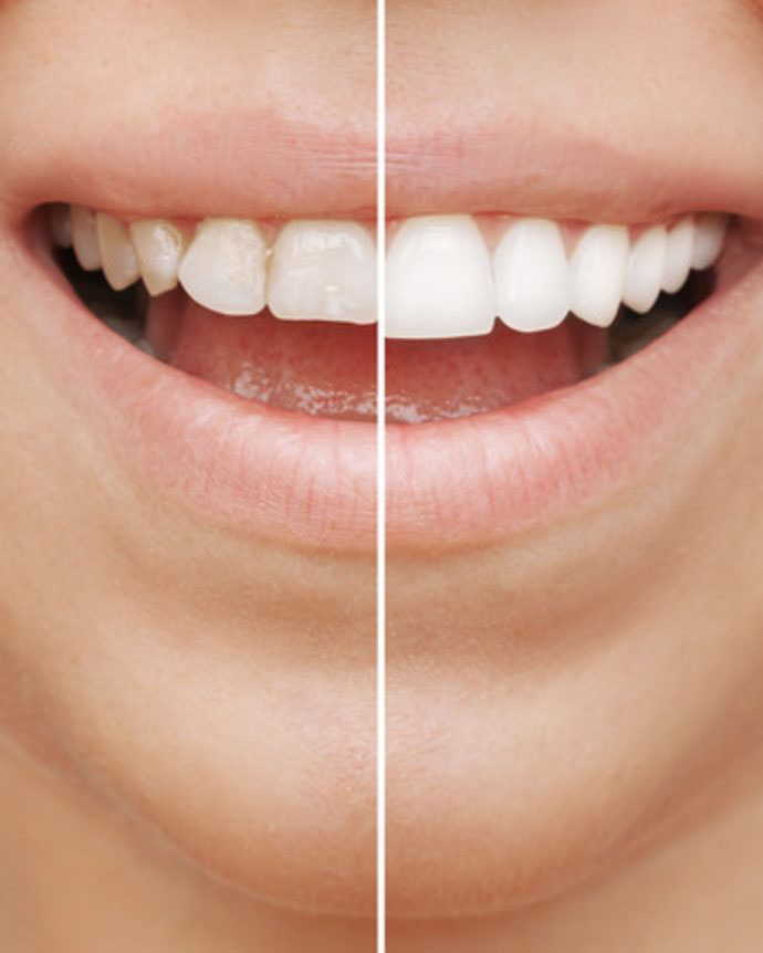 Sherway Gardens Dental Centre