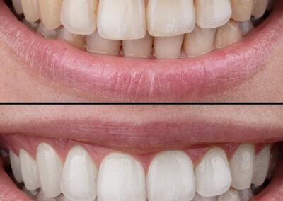 Shore Breeze Dental