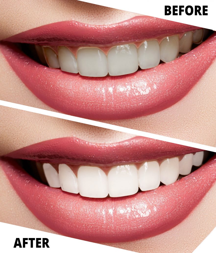 Singhal Dentistry at Lyon and Glebe