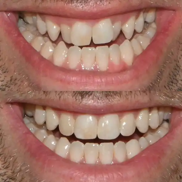 Image of Smiles On Queen | Dentist Bolton clinic - Dental Clinic Directory