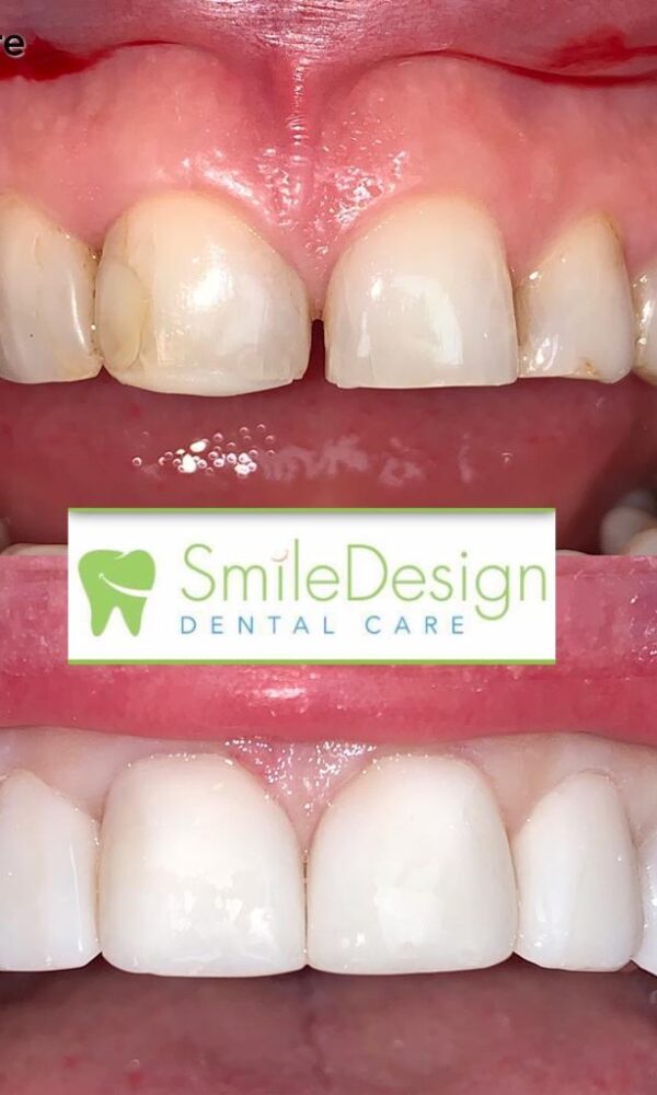 Image of Smile Design Dental Care - Oakville clinic - Dental Clinic Directory