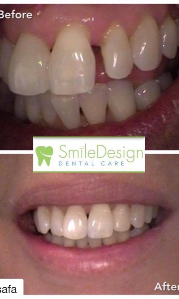 Image of Smile Design Dental Care - Oakville clinic - Dental Clinic Directory