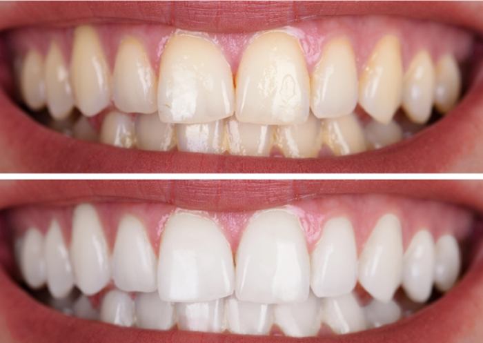 Image of Smile Point Dental clinic - Dental Clinic Directory