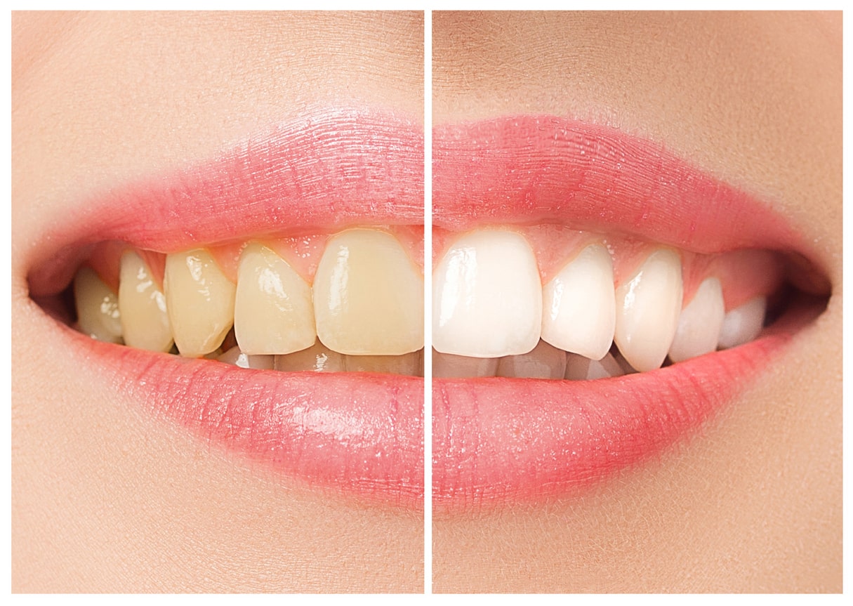 Smiles on Progress ave Dentistry