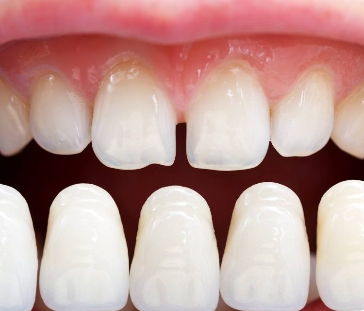 Image of Smileton Dental clinic - Dental Clinic Directory