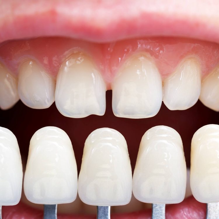 Smileton Dental