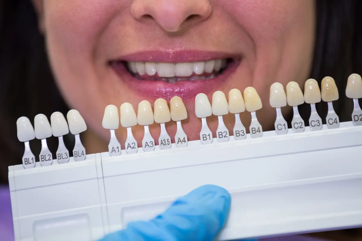 Image of Smileton Dental clinic - Dental Clinic Directory