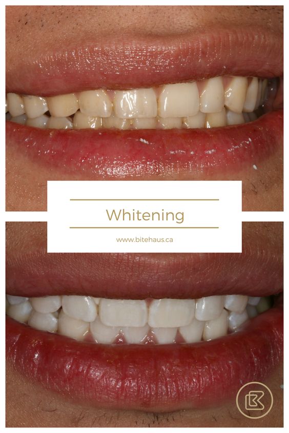 Image of Bitehaus Dental clinic - Dental Clinic Directory
