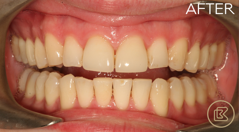 Image of Bitehaus Dental clinic - Dental Clinic Directory