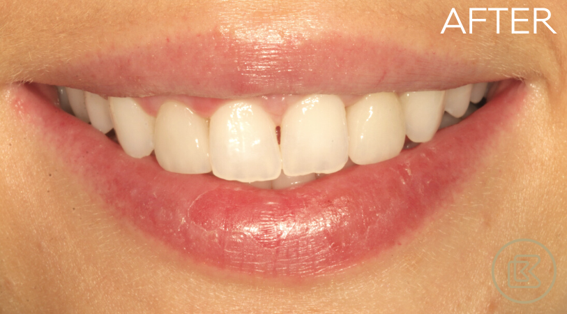 Image of Bitehaus Dental clinic - Dental Clinic Directory
