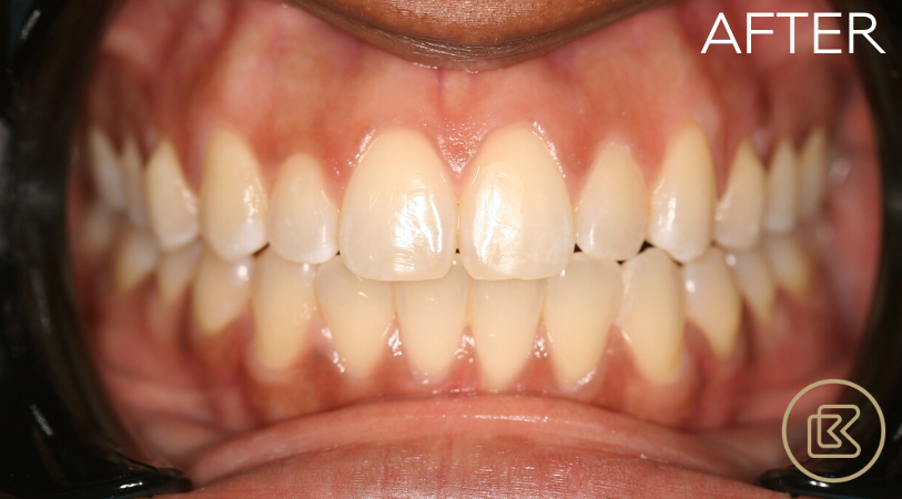 Image of Bitehaus Dental clinic - Dental Clinic Directory