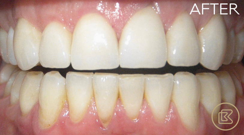 Image of Bitehaus Dental clinic - Dental Clinic Directory