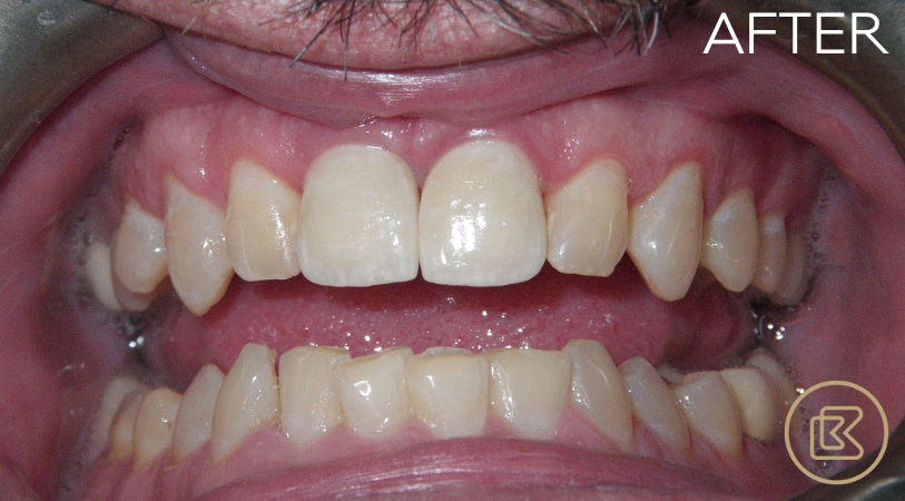 Image of Bitehaus Dental clinic - Dental Clinic Directory
