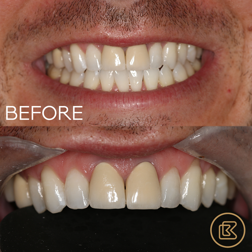 Bitehaus Dental
