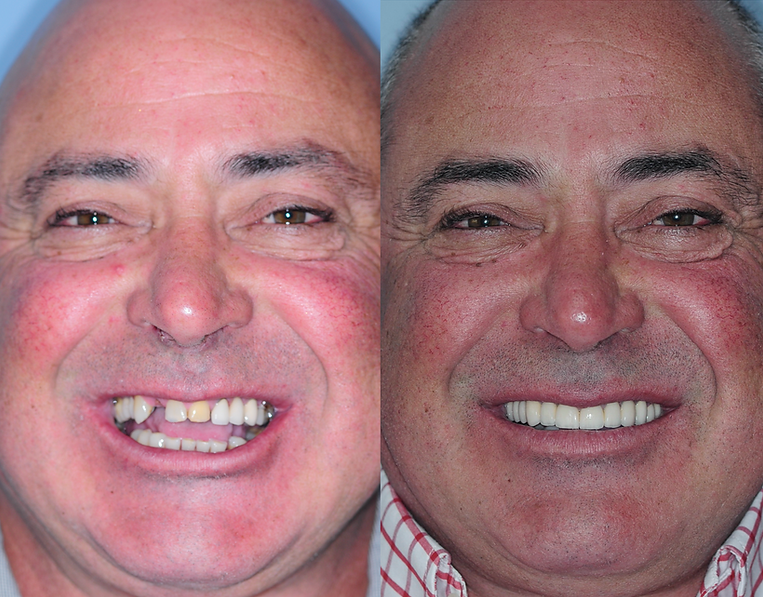 Kitchener Waterloo Prosthodontics