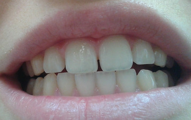 Image of RiverLake Dental clinic - Dental Clinic Directory