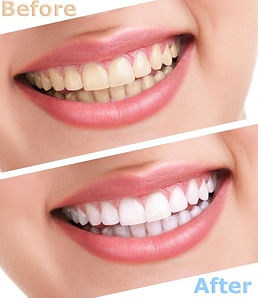 Image of RiverLake Dental clinic - Dental Clinic Directory