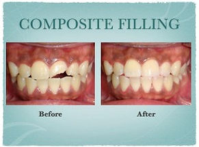 Elliot Lake Dental Centre-Dr. Nathan Haas