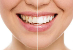 Laird Dental Associates