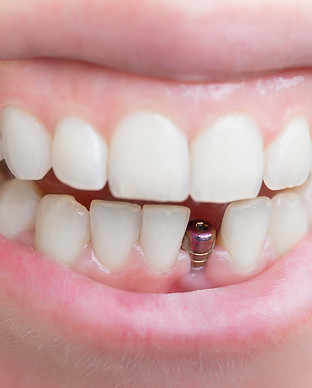 Image of Aquadent Dental Care clinic - Dental Clinic Directory