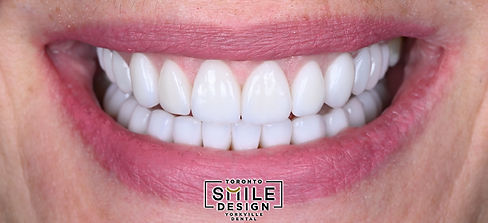 Toronto Smile Design - Yorkville Dental