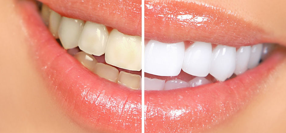 Image of Clyde Prosthodontics Dr. Yelitza R. Ararat clinic - Dental Clinic Directory