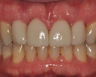 Image of Clyde Prosthodontics Dr. Yelitza R. Ararat clinic - Dental Clinic Directory