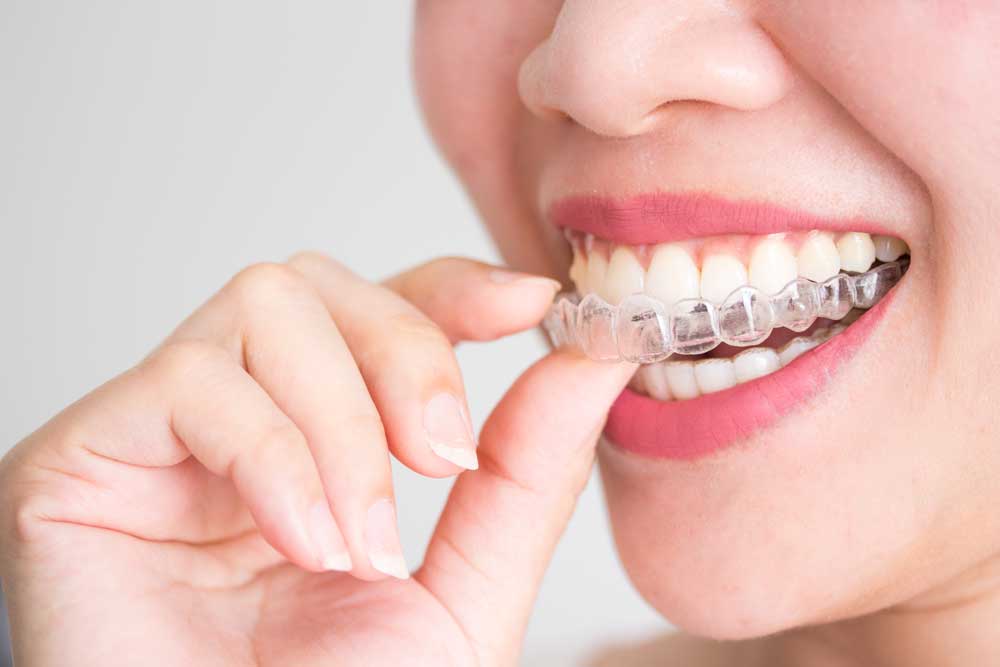 Image of Summersmiles Family Dental clinic - Dental Clinic Directory